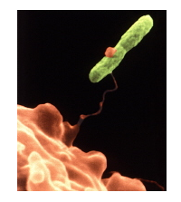Image of the typical Legionella bacterium (Fraser, et.al, 1977).