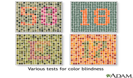 standard test used in order to determine if a person is color blind