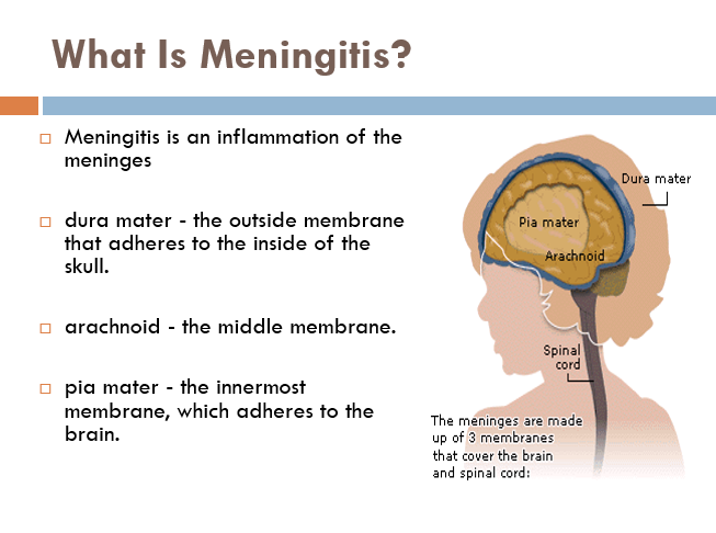 What Is Meningitis