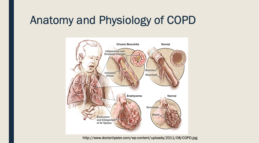 Anatomy and Physiology of COPD